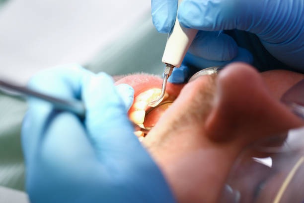 Best Broken Tooth Emergency  in Linganore, MD