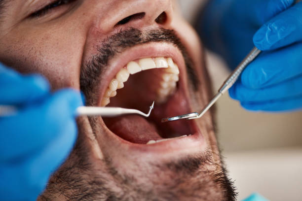 Best Dentist for Dental Trauma  in Linganore, MD